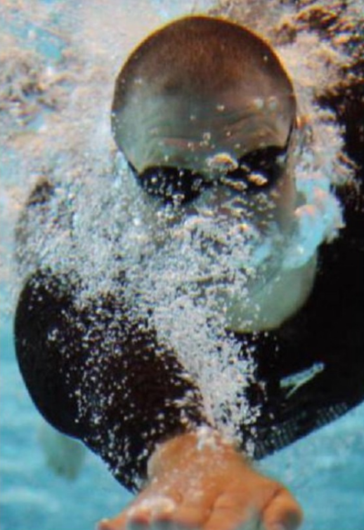 Anders Olsson Invacare